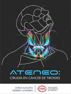 Ateneo: Cirugía en cáncer de tiroides